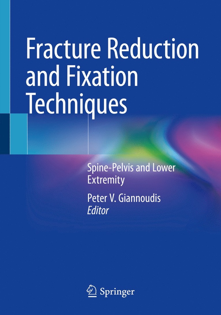 Peter V. Giannoudis - Fracture Reduction and Fixation Techniques, Häftad