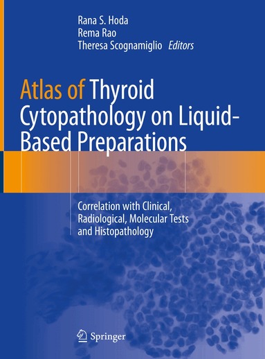 Rana S. Hoda, Rema Rao, Theresa Scognamiglio - Atlas of Thyroid Cytopathology on Liquid-Based Preparations, Inbunden