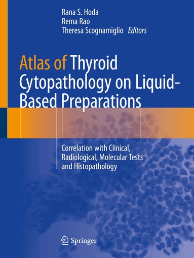 Rana S. Hoda, Rema Rao, Theresa Scognamiglio - Atlas of Thyroid Cytopathology on Liquid-Based Preparations, Häftad