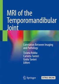 bokomslag MRI of the Temporomandibular Joint