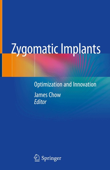 James Chow - Zygomatic Implants, Inbunden