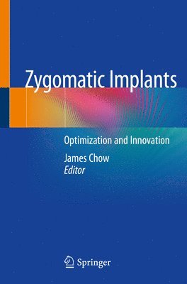 James Chow - Zygomatic Implants, Häftad