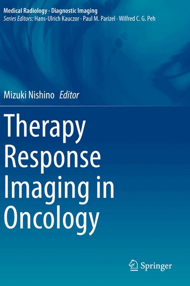 Mizuki Nishino - Therapy Response Imaging in Oncology, Häftad