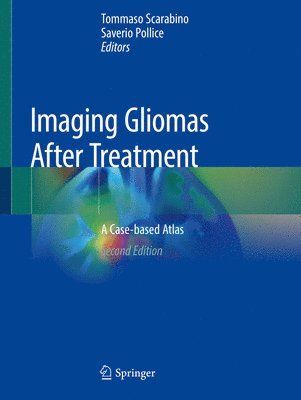bokomslag Imaging Gliomas After Treatment