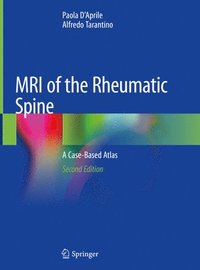 bokomslag MRI of the Rheumatic Spine