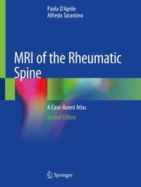 bokomslag MRI of the Rheumatic Spine