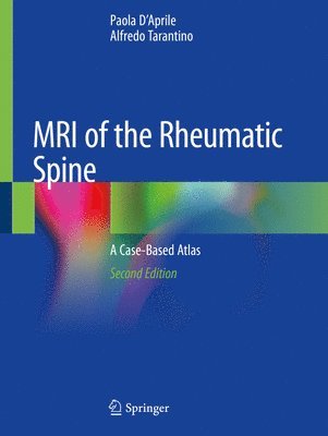 MRI of the Rheumatic Spine 1