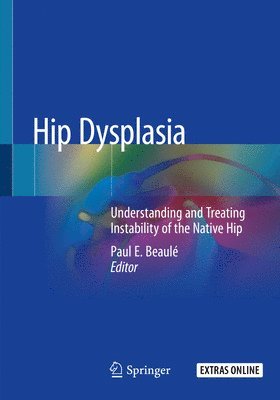 Hip Dysplasia 1