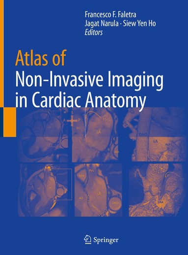 Francesco F. Faletra, Jagat Narula, Siew Yen Ho - Atlas of Non-Invasive Imaging in Cardiac Anatomy, Inbunden