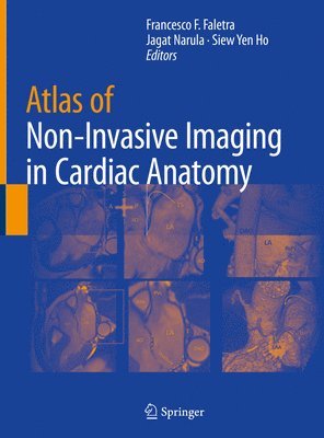 bokomslag Atlas of Non-Invasive Imaging in Cardiac Anatomy