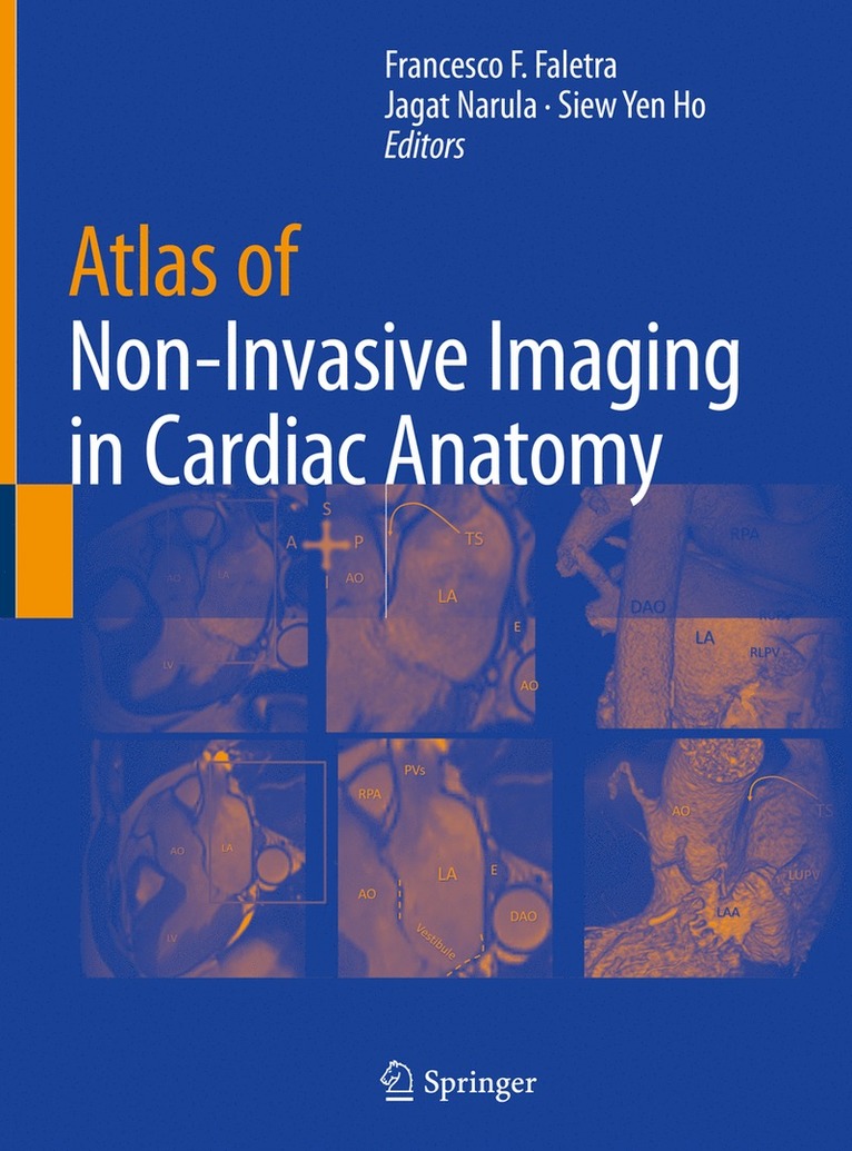 Francesco F. Faletra, Jagat Narula, Siew Yen Ho - Atlas of Non-Invasive Imaging in Cardiac Anatomy, Inbunden