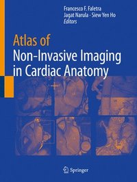 bokomslag Atlas of Non-Invasive Imaging in Cardiac Anatomy