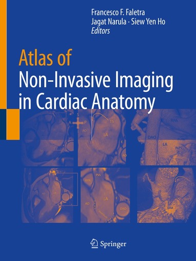 Francesco F. Faletra, Jagat Narula, Siew Yen Ho - Atlas of Non-Invasive Imaging in Cardiac Anatomy, Häftad