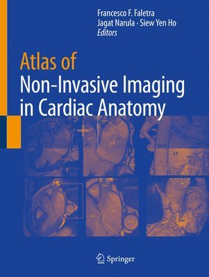 Atlas of Non-Invasive Imaging in Cardiac Anatomy 1