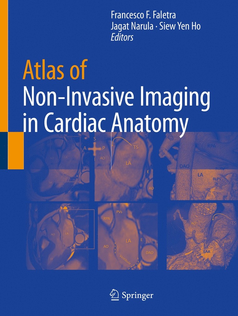 Francesco F. Faletra, Jagat Narula, Siew Yen Ho - Atlas of Non-Invasive Imaging in Cardiac Anatomy, Häftad