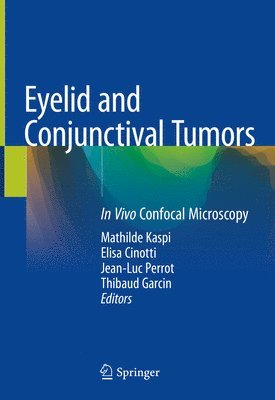 bokomslag Eyelid and Conjunctival Tumors