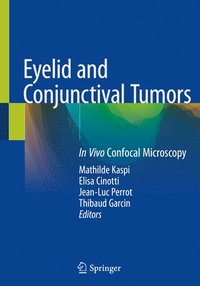 bokomslag Eyelid and Conjunctival Tumors