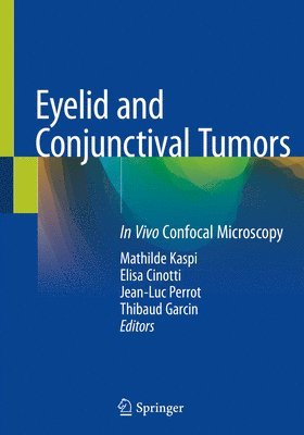 Eyelid and Conjunctival Tumors 1