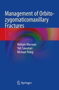 bokomslag Management of Orbito-zygomaticomaxillary Fractures