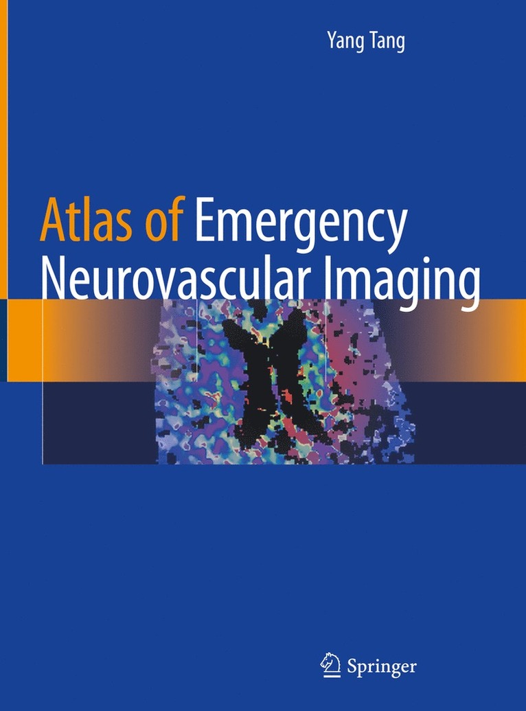 Yang Tang - Atlas of Emergency Neurovascular Imaging, Inbunden
