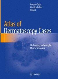 bokomslag Atlas of Dermatoscopy Cases