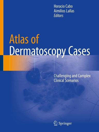 Horacio Cabo, Aimilios Lallas - Atlas of Dermatoscopy Cases, Häftad