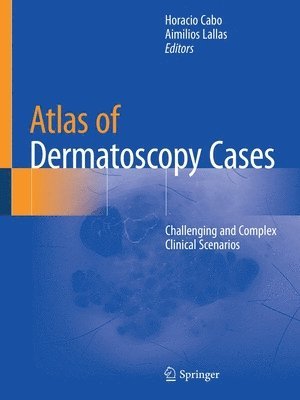 bokomslag Atlas of Dermatoscopy Cases