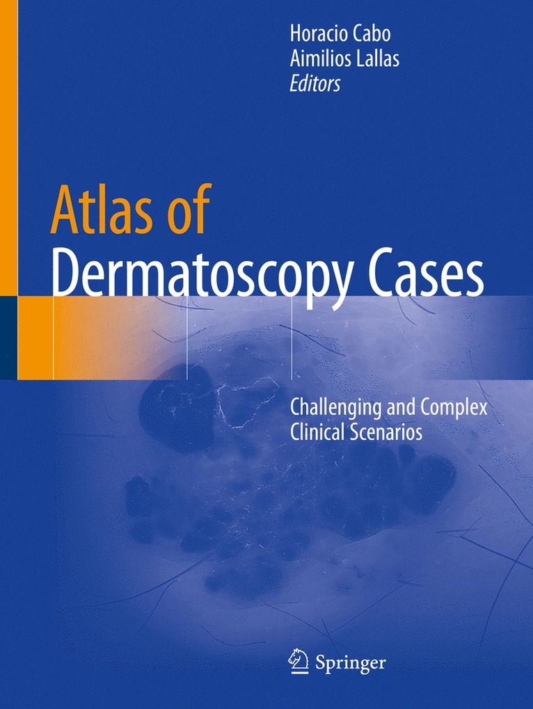 Horacio Cabo, Aimilios Lallas - Atlas of Dermatoscopy Cases, Häftad