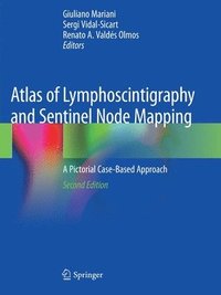 bokomslag Atlas of Lymphoscintigraphy and Sentinel Node Mapping