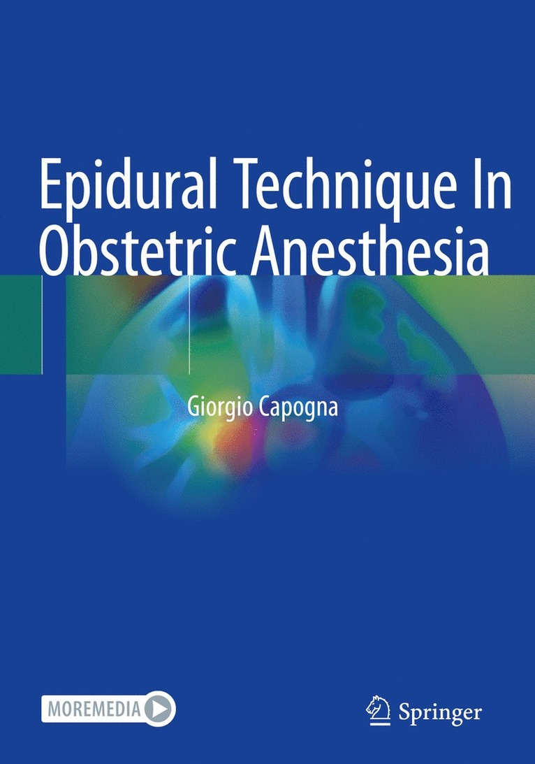 Giorgio Capogna - Epidural Technique In Obstetric Anesthesia, Häftad