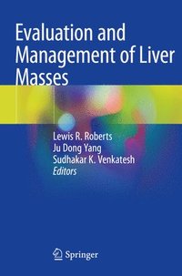 bokomslag Evaluation and Management of Liver Masses