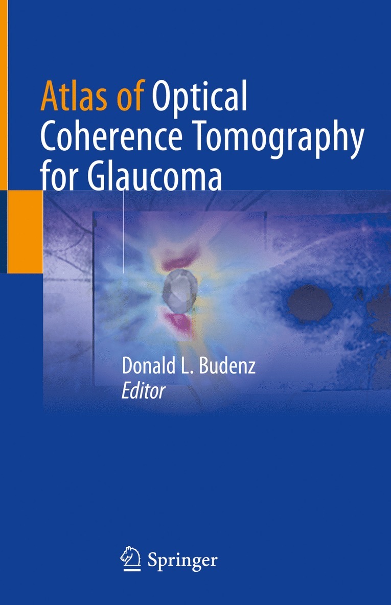 Donald L. Budenz - Atlas of Optical Coherence Tomography for Glaucoma, Inbunden