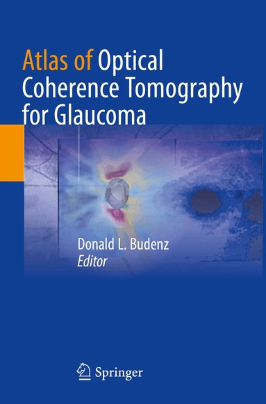 Donald L. Budenz - Atlas of Optical Coherence Tomography for Glaucoma, Häftad