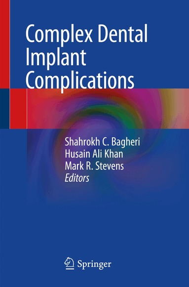 Shahrokh C. Bagheri, Husain Ali Khan, Mark R. Stevens - Complex Dental Implant Complications, Häftad