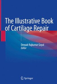 bokomslag Illustrative Book of Cartilage Repair
