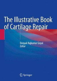 bokomslag Illustrative Book of Cartilage Repair