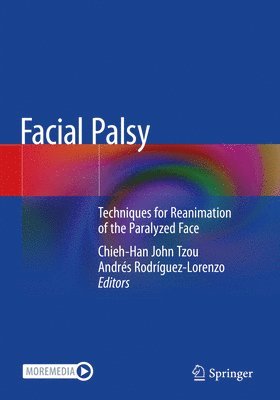 bokomslag Facial Palsy