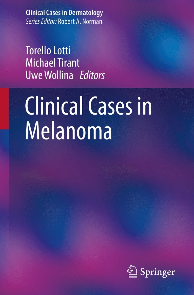 Torello Lotti, Michael Tirant, Uwe Wollina - Clinical Cases in Melanoma, Häftad