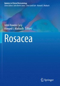 bokomslag Rosacea