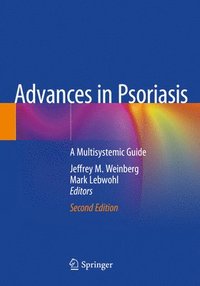 bokomslag Advances in Psoriasis