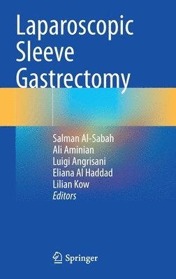 Laparoscopic Sleeve Gastrectomy 1