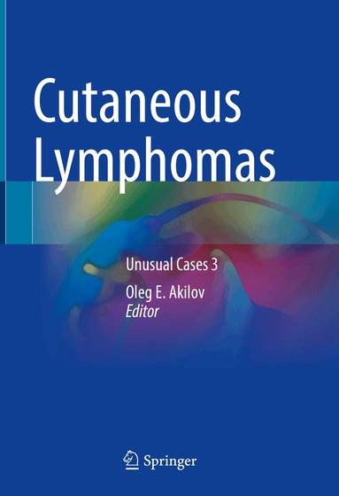 Oleg E. Akilov - Cutaneous Lymphomas, Inbunden