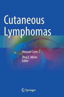 Oleg E. Akilov - Cutaneous Lymphomas, Inbunden