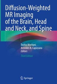 bokomslag Diffusion-Weighted MR Imaging of the Brain, Head and Neck, and Spine