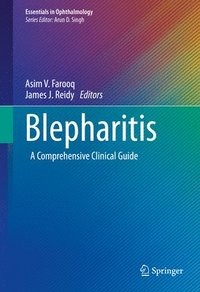 bokomslag Blepharitis