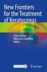 bokomslag New Frontiers for the Treatment of Keratoconus