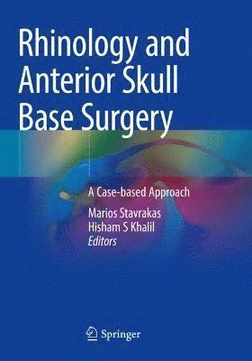 Marios Stavrakas, Hisham S Khalil, Hisham S. Khalil - Rhinology and Anterior Skull Base Surgery, Häftad