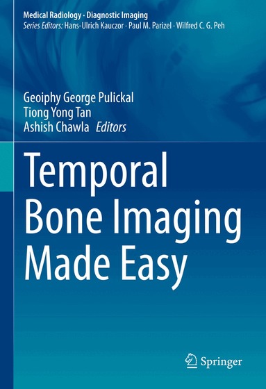 Geoiphy George Pulickal, Tiong Yong Tan, Ashish Chawla - Temporal Bone Imaging Made Easy, Inbunden