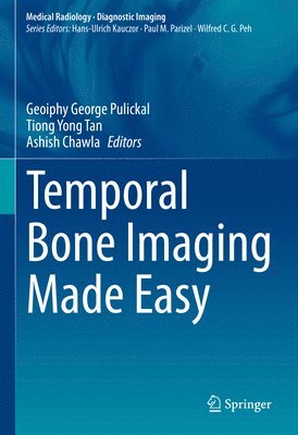 Geoiphy George Pulickal, Tiong Yong Tan, Ashish Chawla - Temporal Bone Imaging Made Easy, Inbunden