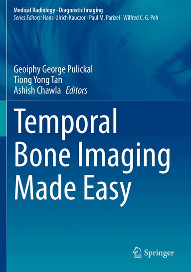 Geoiphy George Pulickal, Tiong Yong Tan, Ashish Chawla - Temporal Bone Imaging Made Easy, Häftad